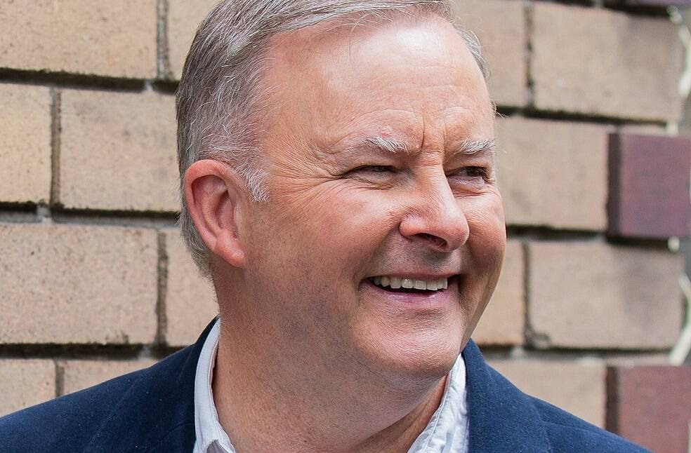 Anthony Albanese