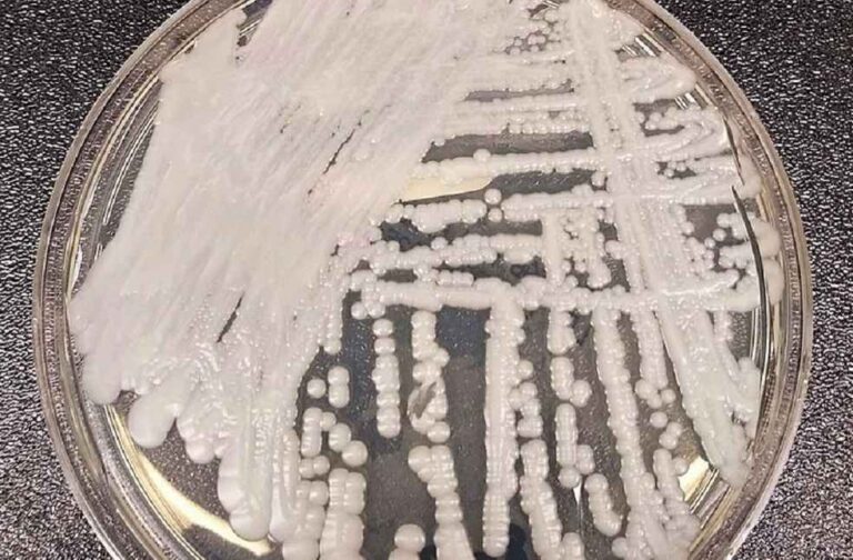 Superbug Fungus Study