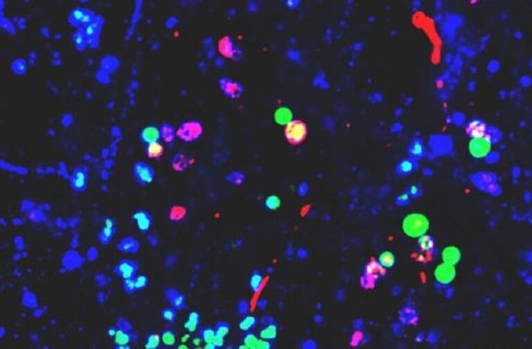 Nanoplastics linked to Parkinson's brain proteins changes