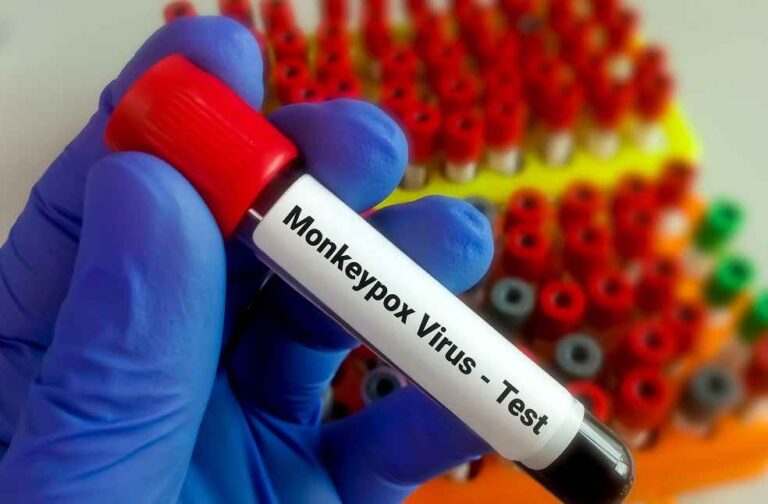 Monkeypox _ New global health threat