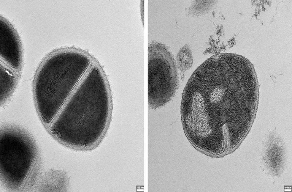 Hidden immune defence discovered_Image Via_Weizmann Institute of Science_11zon