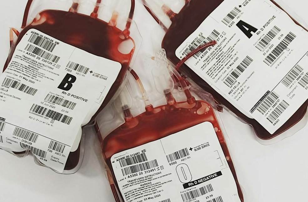 NHS calls for 1 million donors to avert blood shortage_Image Via_Pexels