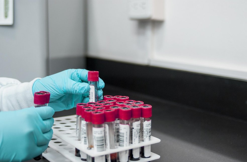 Rack filled with multiple test tubes prepared for a blood test