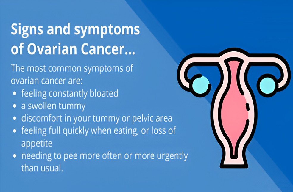 Ovarian Cancer early detection-Image Via-FB-NHS