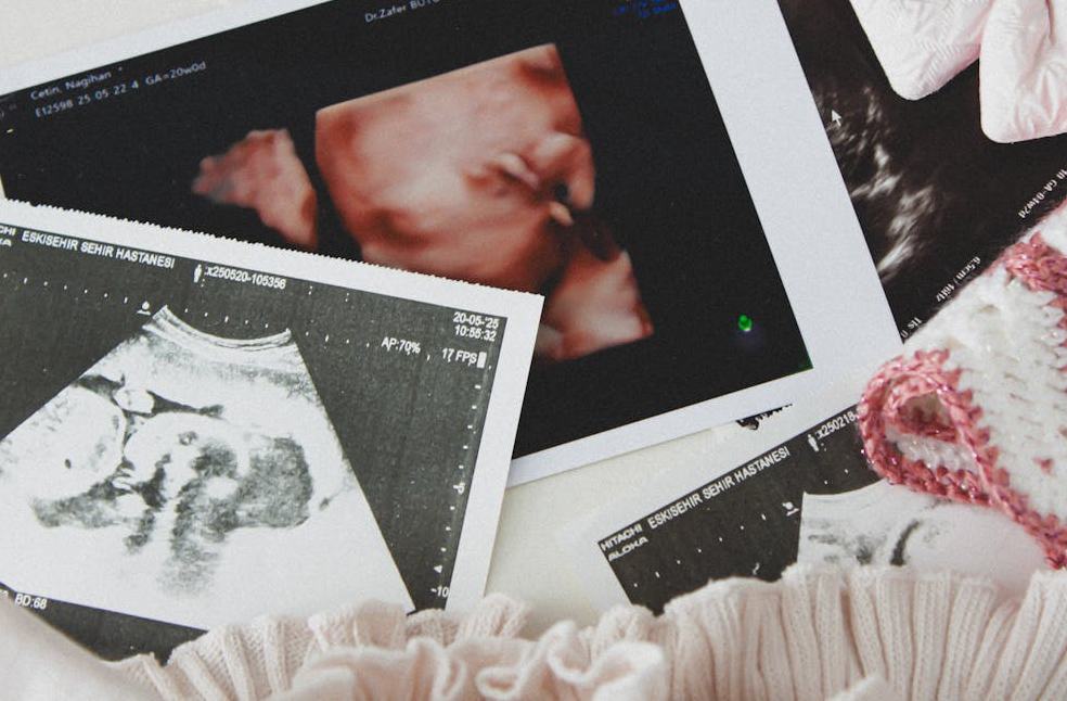 Ultrasound Photos with Baby Clothing and Accessories
