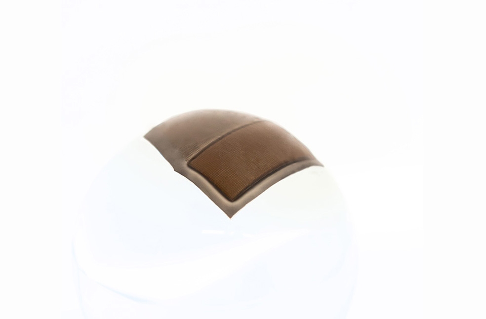 Wearable Ultrasound Tech-Image Via-UC San Diego