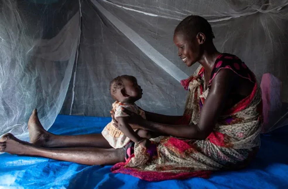 Zimbabwe malaria surge-Image Via-UNICEF