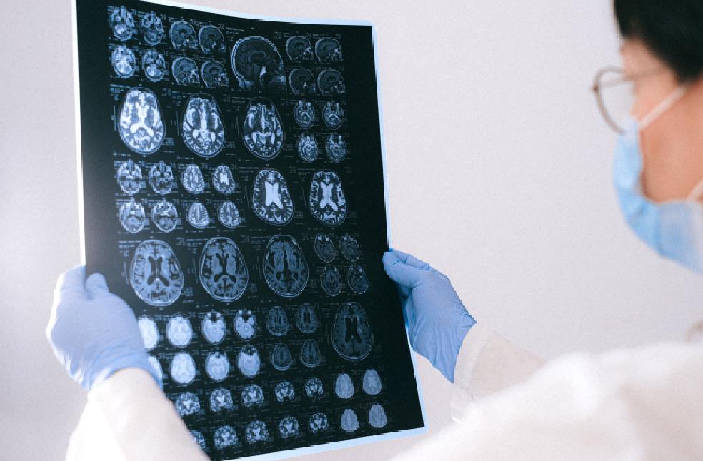 A medical professional reviewing MRI brain scans in a clinical setting, highlighting healthcare technology