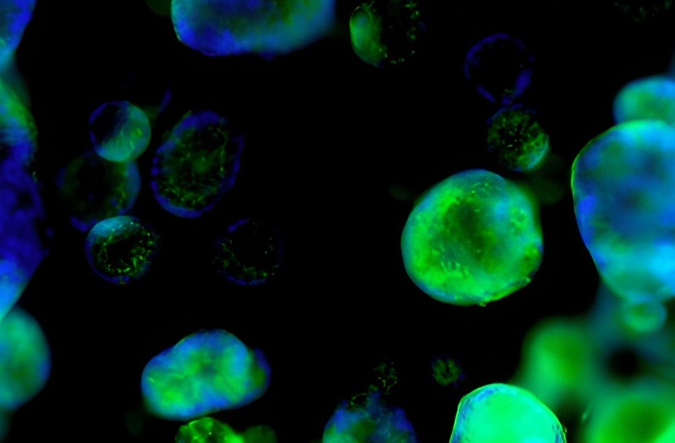 NHS organoid Research-Image Via-ICL